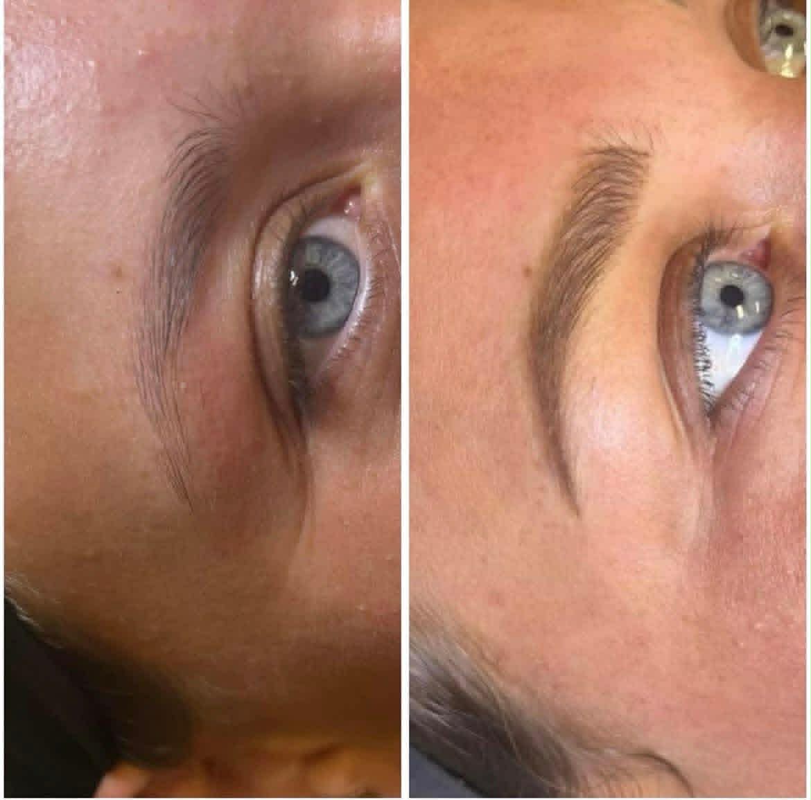 Single-eye nano brow close-up, before and after